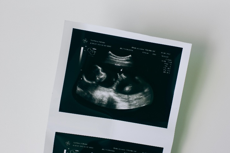 Bambino nei primi mesi di gestazione 