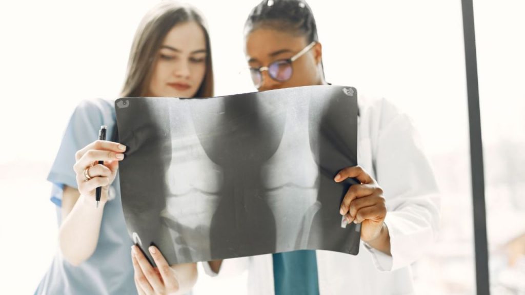 Osteoporosi, buone notizie: scoperto un gel che densifica le ossa | La sperimentazione è in corso