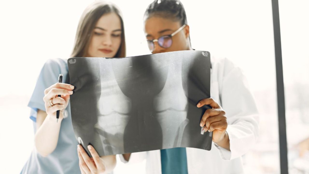 Osteoporosi, buone notizie: scoperto un gel che densifica le ossa | La sperimentazione è in corso