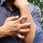 persona che si gratta il braccio